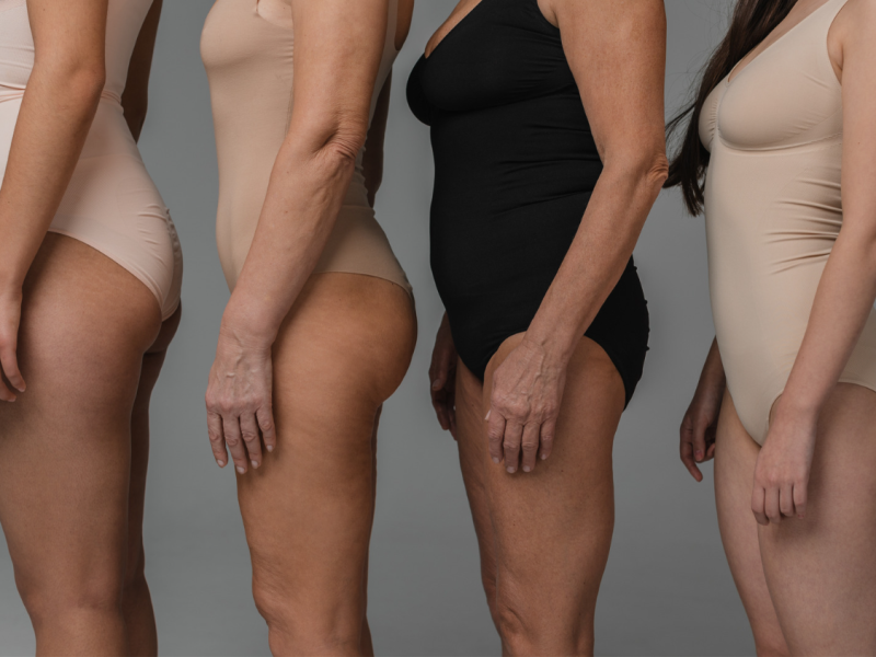 Look at the before and after! Shapewear makes a difference